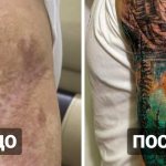 20 tattoos over scars and burns that helped people turn their flaws into a highlight