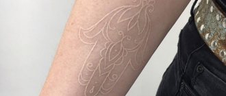 Contour white tattoo on arm