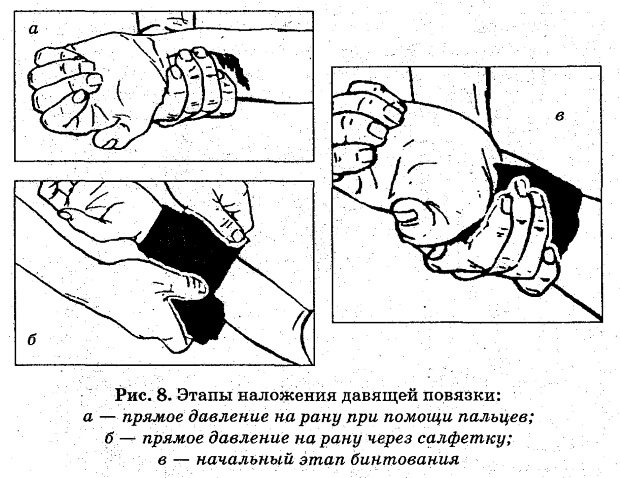 How to apply a bandage.